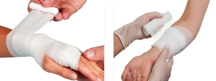 PBT Conforming Bandage price PBT Conforming Bandage price